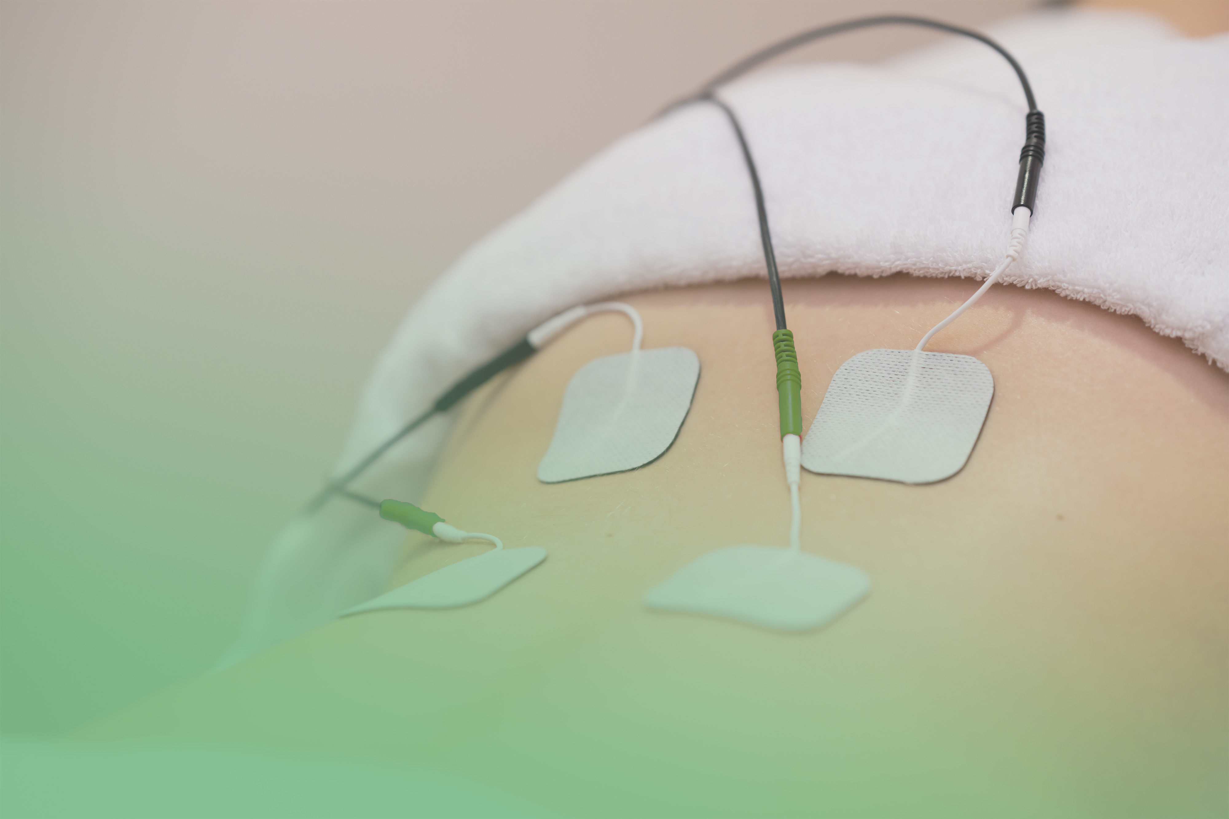 a lower back with electric current patches 